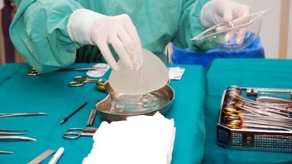 krūšu palielināšanas implants